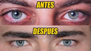 Cómo Tener Ojos Atractivos Y Bonitos Hombres  5 Maneras Fáciles [upl. by Esiom]