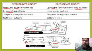 DIFFERENCE BETWEEN DECEREBRATE AND DECORTICATE RIGIDITY DECORTICATERIGIDITY DECEREBRATERIGIDITY [upl. by Pontius972]