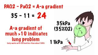 Arterial blood gas interpretation in 5 min [upl. by Yeneffit]