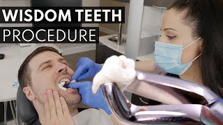 Wisdom Teeth Extraction PROCEDURE  How to Prepare What to Expect amp Cost [upl. by Carita886]