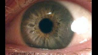 Eye Works 1 Focusing Cornea Iris and Lens [upl. by Ennaear280]