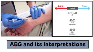 Arterial Blood Gas ABG Analysis  Arterial Blood Gas ABG Interpretations In 3 Easy Steps [upl. by Serrell]