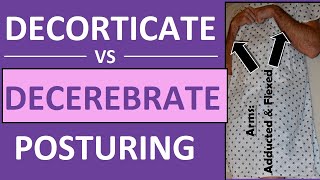 Decerebrate vs Decorticate Posturing Rigidity Mnemonic amp Pictures Nursing NCLEX [upl. by Gipson688]