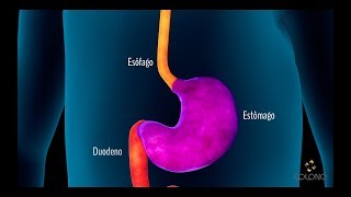 Endoscopia Digestiva Alta [upl. by Clein]