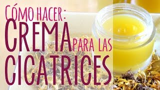 Crema casera para las cicatrices [upl. by Analem]