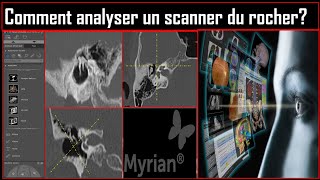 Comment analyser un scanner du rocher [upl. by Nelo]