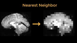 Resampling MRI Data Common Uses and Pitfalls [upl. by Ellyn645]