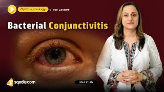 Bacterial Conjunctivitis  Ophthalmology Video Lecture  Medical Student VLearning [upl. by Agiaf]