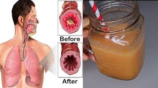 Drink to Get Help Rid Of Phlegm Cold And Mucus In Chest And Throat [upl. by Eiramyllek]